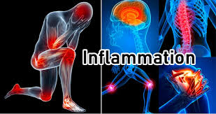 Inflammation